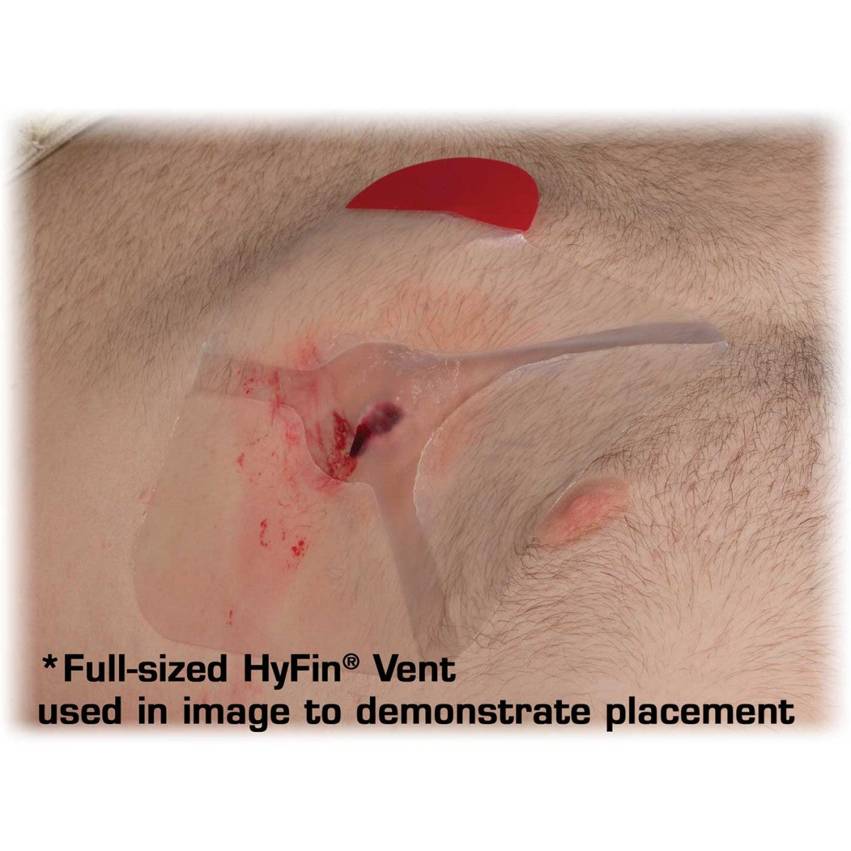 Hyfin Compact Vented Chest Seal Twin Pack - image 5